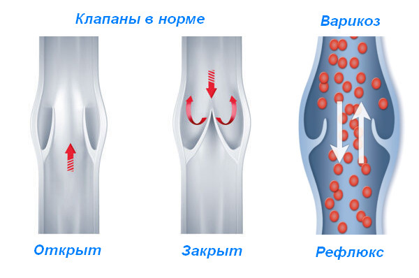 клапаны.jpg